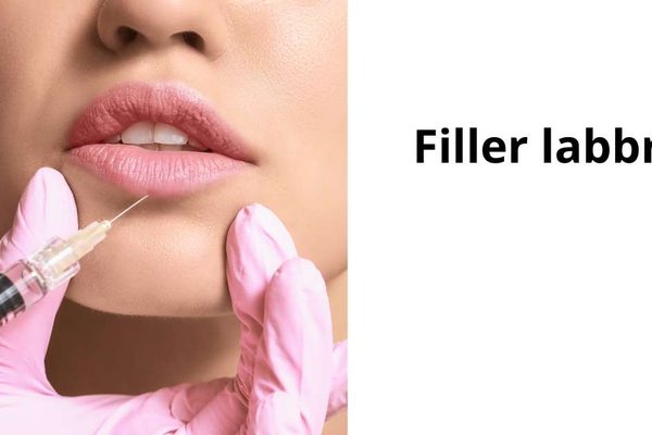 Filler labbra con acido ialuronico